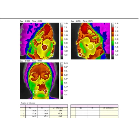 Figure 3 Method for taking an image with thermography. A: Thermography IRIS-5000. B: Taking the image with thermography