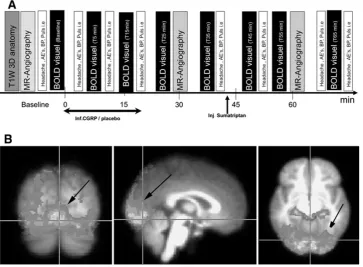 Fig. 1 a The experimental paradigm. Baseline recordings wereperformed at T-5min. All participants randomly received infusion ofCGRP (1.5 g/min) or placebo over 20 min