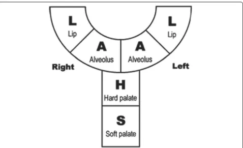 Fig. 1 a–d Veau classification system of cleft lip and palate