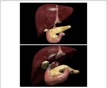 Fig. 11 Application of a force (indicated by an arrow) that makes liver and gallbladder to get into contact