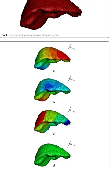 Fig. 4 Finite element mesh for the parenchyma of the liver