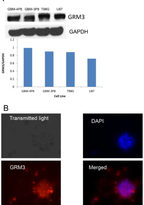 Figure 1: GRM3 is expressed in human gliomas.  (A) Western immunoblots of commercially available human glioma cell lines 