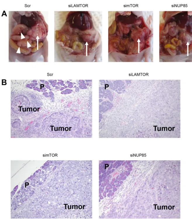 Figure 8: Disease progression in the orthotopic mouse model of PDAC.  (A) Representative S2-013-derived PDAC tumor  tissues in S2-013 tumor-bearing mice treated with scrambled control PEG-COL nanoparticles (Scr) and target  siRNA-FA-PEG-COL nanoparticles a