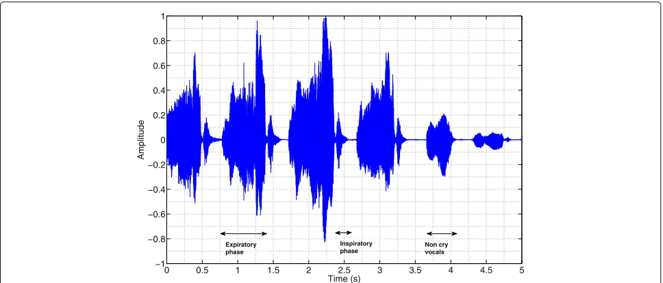 Fig. 1 An example of a chunk of infant cry signal showing expiratory and inspiratory phases and non-cry vocals present in the recording(categorized as residual)