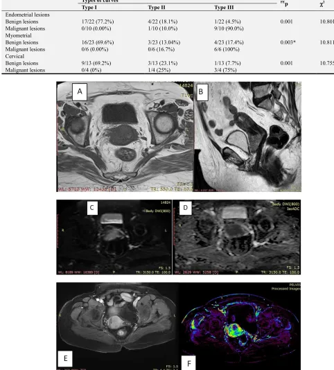 Table 7. Types of curves in different lesions in dynamic contrast enhanced MRI. 