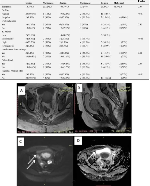Table 3. Conventional MRI findings in the 78 patients. 