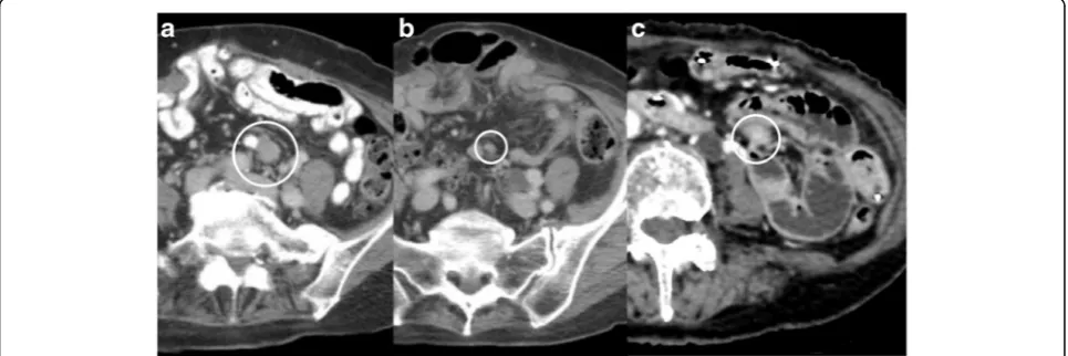 Fig. 1 Case 1 imaging findings. a Abdominal CT at study enrollment. b Abdominal CT 3 months after start of nilotinib therapy