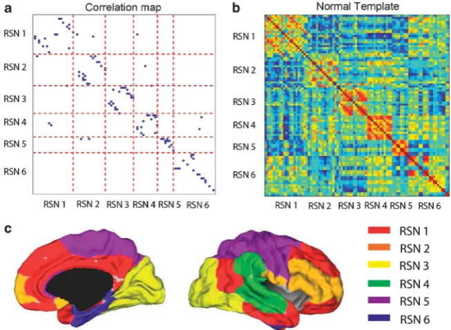 Figure 1(a) Community structure of the normal template. (b) The correlation coefficient matrix of the Blood OxygenationLevel Dependent (BOLD) signals from 90 regions of interest (ROIs) of one randomly selected subject