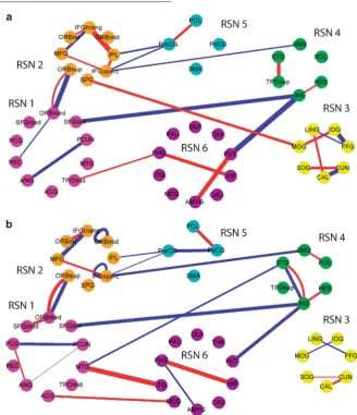 Figure 3(a) Functional network structure with different links of normal template and first-episode major depressivedisorder (FEMDD) patients
