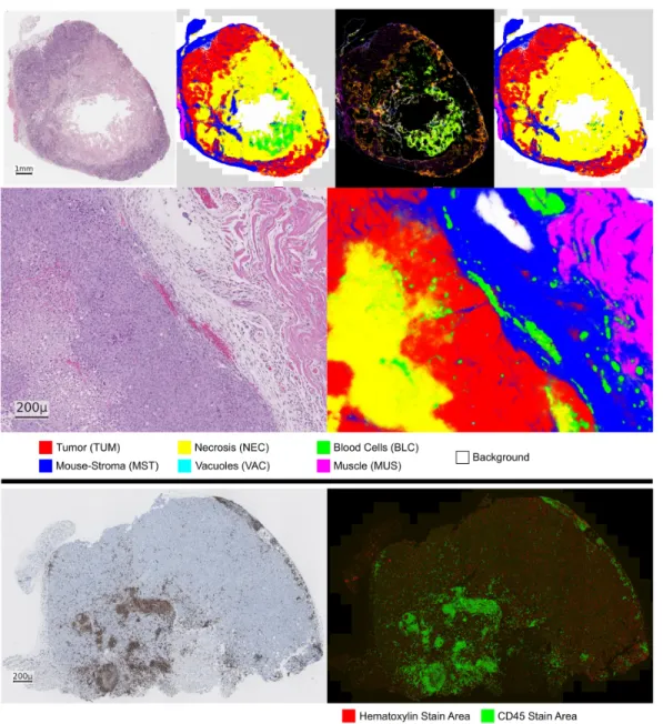 Figure 2: Prediction of the HistoNet architecture on an input sample (NSCLC PDX).  Top, from left to right: input slide,  prediction average map, variance map, corrected tissue map