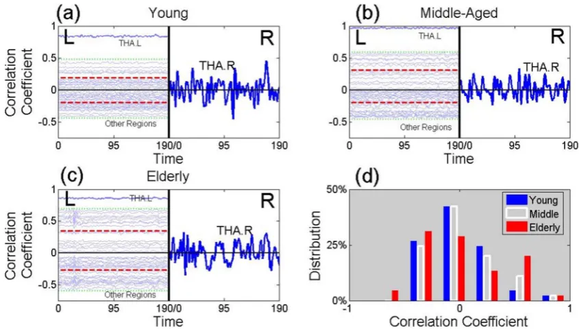 Figure 2 | The Origin of the Functional Entropy. This figure presents time series from BOLD signals