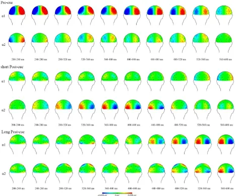 Figure 3. Topographical maps of LPS results for the relevant frequency bands for all conditions