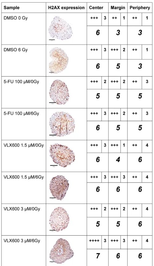 Figure 3: Immunohistochemical expression (centrally and peripherally in spheroids) of gamma-H2AX in HCT116  GFP cells cultured as spheroids for 7 days, then irradiated (6 Gy) at 4–6 h after addition of drug and harvested 24 h  later