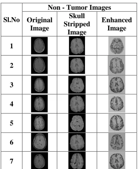 Figure 4:  Experimental results of skull stripped image, enhanced image of non-tumor images  