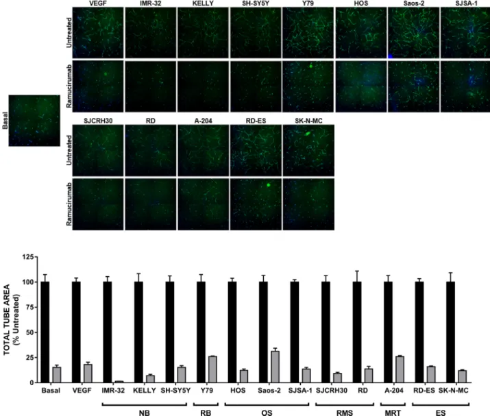 Figure 2: Ramucirumab blocks both VEGF-A- and pediatric tumor cell-driven cord formation in vitro