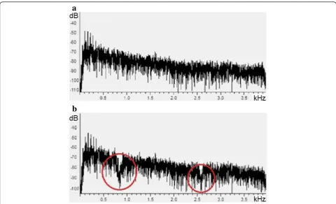Figure 9 Recorded sound spectrum using the third microphone. (a) When the source has been placed behind the reflector; (b) when thesource has been placed in front of the reflector