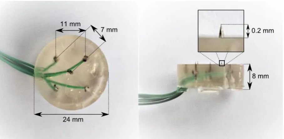 Figure 4 IES preferentially activates nociceptive nerve fibers in the superficial skin (pin-prick sensation at detection level) without initial activation of tactile nerve fibers (non-painful sensation at detection level)