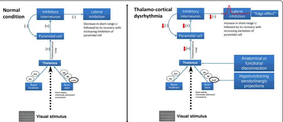 Figure 6 Schematic representation of visual information processing pathway describing the neural network model that canencompass the present findings in both healthy volunteers and migraineurs