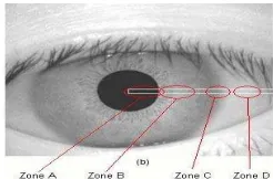 Fig. 7. The steps involved in eyelid localization.   is filtered with a 1D horizontal rank filter