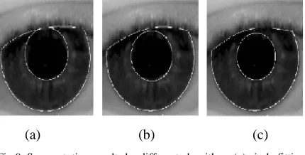 Fig. 8. (a) CASIA  iris image with reflections (b) reflection removed image (c) pupil localization (d) iris boundary localization (e) curve fitting (f) segmented output 