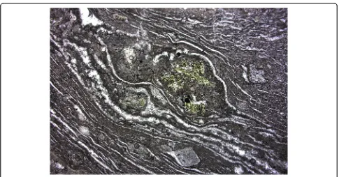 Fig. 7 Thin section, showing an eutaxitic texture from a densely welded pyroclastic flow deposit (upper part in Fig