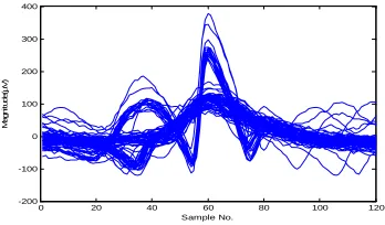 Fig. 1.  Raw EMG signal.  