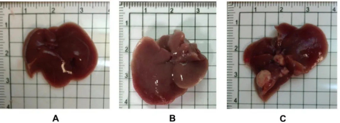 Figure 2:  The overall appearances of the liver organs from both wild-type and Gnmt −/−  mice were relatively normal at the age of 12  months (A: Wild Type, B: Gnmt −/− )