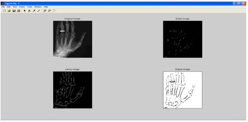Fig 4 Comparison of different algorithms a) Original cameraman Picture (b) Sobel (c) Canny (d) Proposed method  