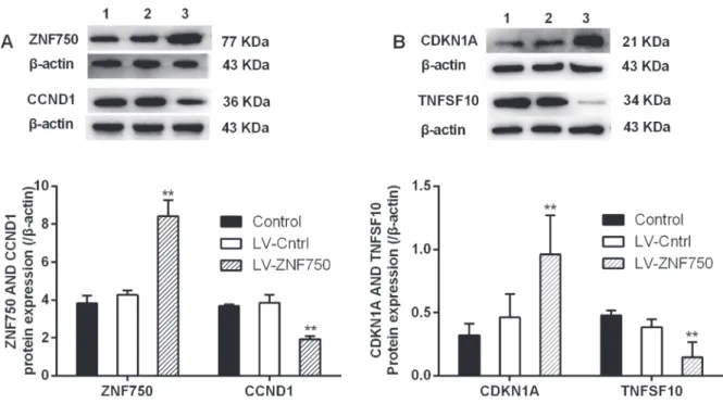 Figure 4:  The changes of CCND1, CDKN1A and TNFSF10 protein expression upon over-expressed ZNF750 (A and B)