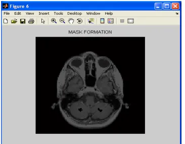 Figure.5 Image after affine transformation                                 Figure.6 Image Residue      