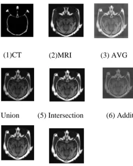 Figure 2: Output results of different IFS fusion methods for medical images. 