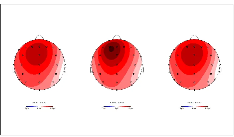 Figure 8. Topographical data shows theta (4 to 6 Hz) power ranging from 0 
