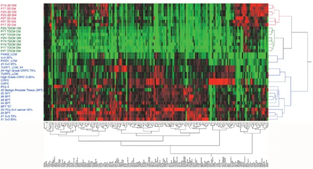 Figure 7: Unsupervised hierarchical clustering.  Reverse phase protein arrays were run on CRCs in either conventional culture or  in the TDCM platform and compared to laser capture microdissected (LCM) primary prostate tissue