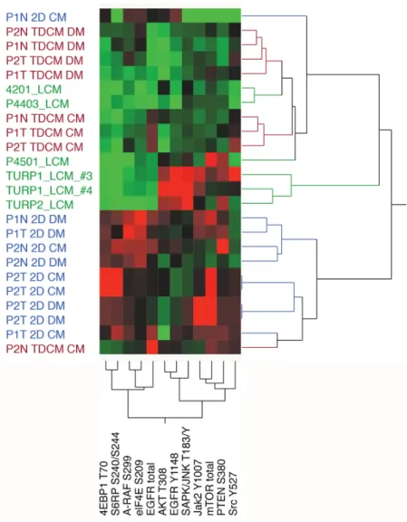 Figure 9: Unsupervised hierarchical analyses.   The protein array data from normal (N) and tumor (T) cells from Patient 1 (P1)  and Patent 2 (P2,) were compared against LCM (laser capture microdissected) castrate resistant (TURP1, TURP2) and localized canc