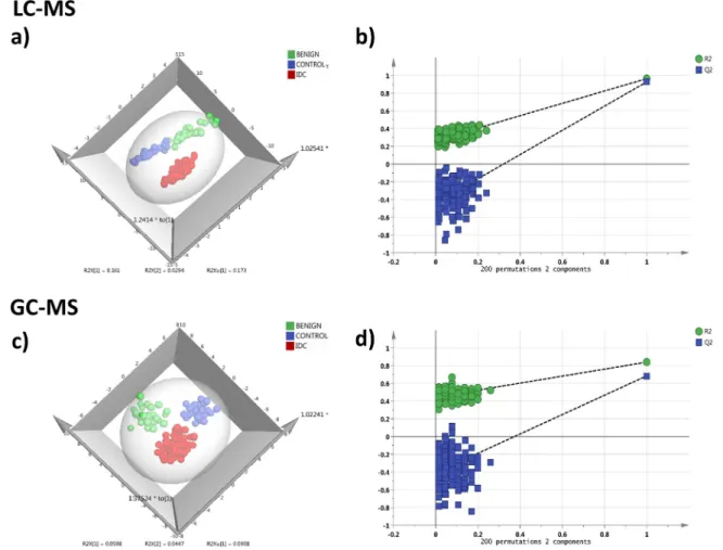 Figure 5: Serum metabolomics multivariate analysis.  LC-MRM/MS: (a) OPLS-DA score plot of serum LC-MRM/MS data for  IDC subjects (n = 76, red), benign breast patients (n = 33, green) and healthy controls (n = 33, blue), (b) plot obtained after performing  