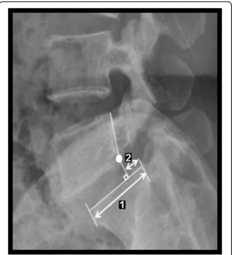 Fig. 1 Degree of spondylolisthesis (%) = distance (2)/distance (1) ×100%. The spondylolisthesis degree was measured as a percentageof the distance from the posterior border of the caudal vertebra tothe posterior border of the rostral vertebra, normalized to thesuperior end plate diameter of the former