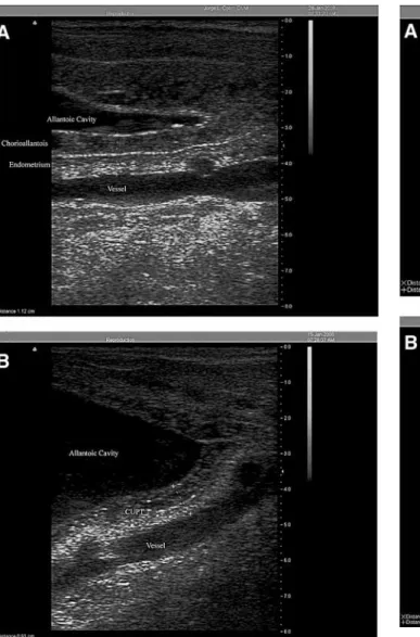 Fig. 3. Abnormal CUPT in two separate cases (A and B) of placentitis with pockets of placental separation containing  hy-perechoic material (cranial is to the left).