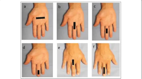 Fig. 1 Hand positions during USG examination of flexor and extensor tendons of the hand and fingers