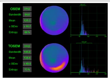 Fig. 4 Phase analysis results from Quantitative Gated SPECT 2012 program for the same patient as in Figure1