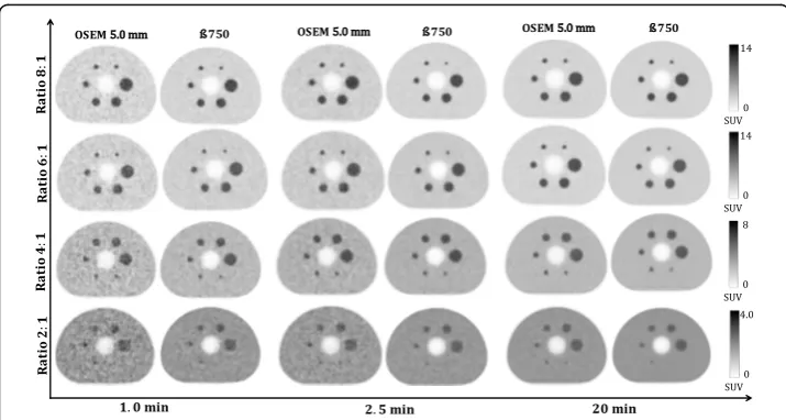 Table 2 Comparison in terms of background COV between TOF-OSEM (3 iterations, 16 subsets,post-filter 5.0 mm and PSF) and BSREM with β = 750 for a volume of 26.52 ml at different countstatistics