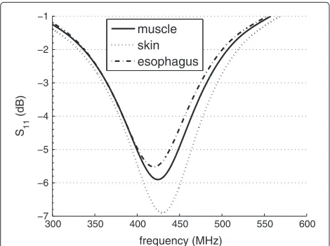 Figure 5 |S11| (dB) of spiral antenna in capsule for three differenttissues.