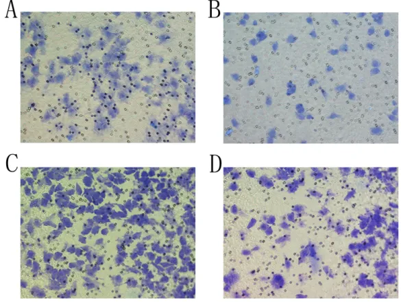 Figure 4: The result of Transwell assay.  (A) In a negative control group, SMMC-7721 cells were observed at the downside of the  chamber