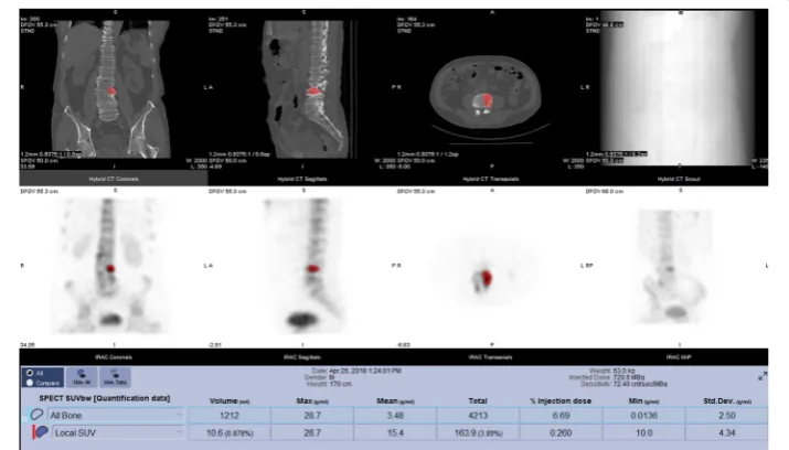 Fig. 1 Iodine-123 mIBG imaging of a 19-year-old male patient with relapsed neuroblastoma