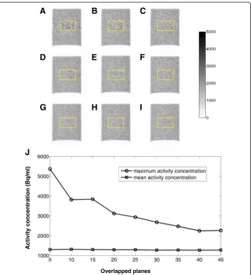 Fig. 7 Coronal slices of the images from a Ge cylinder scan with different PET overlaps in the unit of planes: 5two bed positions.(a), 10 (b), 15 (c), 20 (d), 25 (e), 30 (f), 35 (g), 40 (h), and 45 (i)