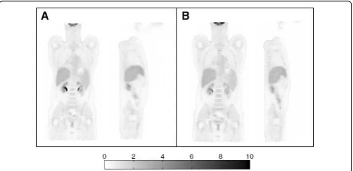 Fig. 8 Reconstructed coronal and sagittal images for a patient scan. The emission data were acquired forfive beds with an overlap of 25 planes (a) and for six beds with an overlap of 45 planes (b)