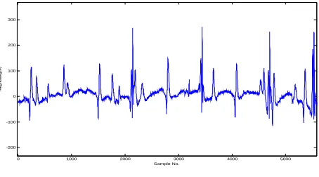 Fig.  2.   Segmented EMG signal in segments of 6ms and centered at the maximum peak. 