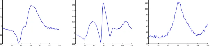 Fig. 3.   Clustered EMG signal of a NOR subject. 