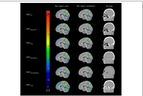 Fig. 4 Examples of z-score maps for one patient (number 16) for the included AC methods, with pons and cerebellum as reference regions, andthe corresponding attenuation maps