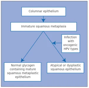 FIGURE 1.6: A schematic diagram of  further maturation of immature squamous metaplasia.