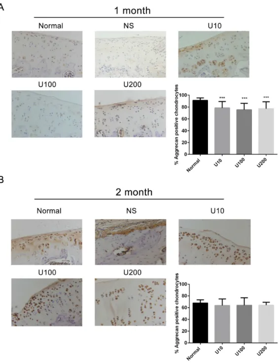 Figure 3: Effect of PLCγ1 inhibitor on Aggrecan expression in a rat OA model.  Specimens were longitudinally cut into 3 μm  sections and the levels of Aggrecan expression level were detected by immunohistochemisty technique (original magnification ×200)